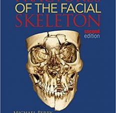 fractures of the facial skeleton 2nd edition
