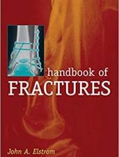 handbook of fractures, third edition 3rd edition