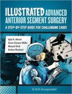 illustrated advanced anterior segment surgery: a step by step guide for challenging cases 1st edition