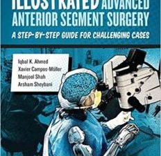 illustrated advanced anterior segment surgery: a step by step guide for challenging cases 1st edition