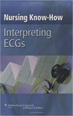 interpreting ecgs (nursing know how) 1st edition
