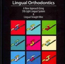 lingual orthodontics: a new approach using stb light lingual system and lingual straight wire