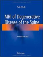 mri of degenerative disease of the spine: a case based atlas