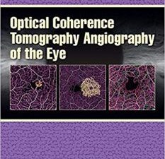 optical coherence tomography angiography of the eye: oct angiography