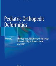 pediatric orthopedic deformities, volume 2: developmental disorders of the lower extremity: hip to knee to ankle and foot