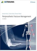 periprosthetic fracture management 1st edition