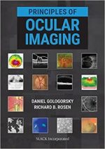 principles of ocular imaging 1st edition