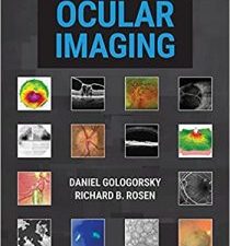 principles of ocular imaging 1st edition