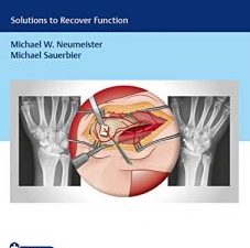 problems in hand surgery: solutions to recover function