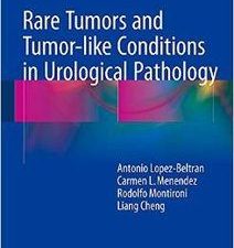 rare tumors and tumor like conditions in urological pathology