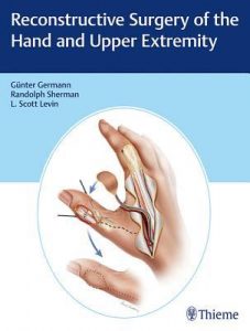 reconstructive surgery of the hand and upper extremity