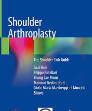 shoulder arthroplasty: the shoulder club guide