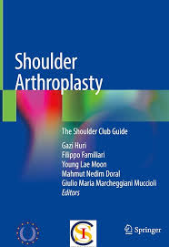 shoulder arthroplasty: the shoulder club guide