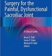 surgery for the painful, dysfunctional sacroiliac joint: a clinical guide