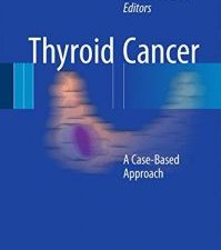 thyroid cancer: a case based approach