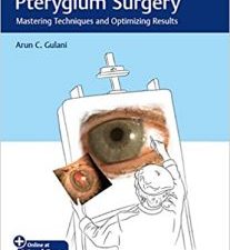 the art of pterygium surgery: mastering techniques and optimizing results