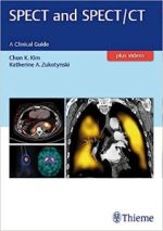 spect and spect/ct: a clinical guide illustrated edition