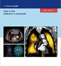 spect and spect/ct: a clinical guide illustrated edition