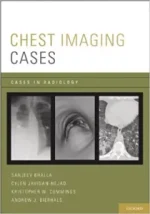 chest imaging cases (cases in radiology) illustrated edition