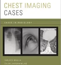 chest imaging cases (cases in radiology) illustrated edition