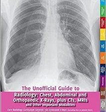 unofficial guide to radiology: chest, abdominal and orthopaedic x rays, plus cts, mris and other important modalities: core radiology curriculum (unofficial guides) 1st edition