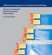 bone and joint disorders (differential diagnosis in conventional radiology) 2nd edition
