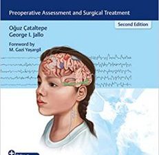 pediatric epilepsy surgery: preoperative assessment and surgical treatment 2nd edition