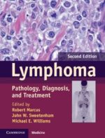 lymphoma: pathology, diagnosis, and treatment 2nd edition