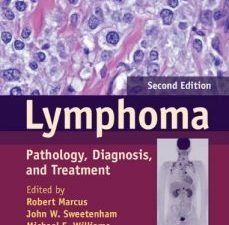 lymphoma: pathology, diagnosis, and treatment 2nd edition