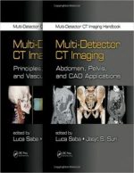 multi detector ct imaging handbook, two volume set 1st edition