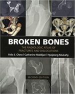 broken bones: the radiologic atlas of fractures and dislocations 2nd edition