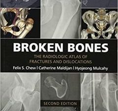 broken bones: the radiologic atlas of fractures and dislocations 2nd edition