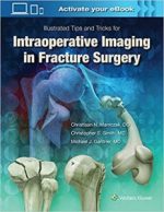 illustrated tips and tricks for intraoperative imaging in fracture surgery first edition