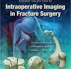 illustrated tips and tricks for intraoperative imaging in fracture surgery first edition