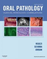 oral pathology – e book 6th edition