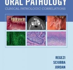 oral pathology – e book 6th edition