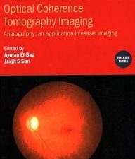 photo acoustic and optical coherence tomography imaging: angiography: – an application in vessel imaging (volume 3)