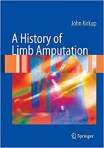 a history of limb amputation