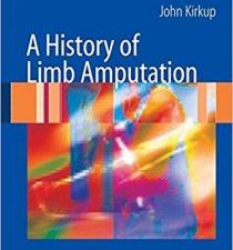 a history of limb amputation