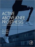 active above knee prosthesis: a guide to a smart prosthetic leg 1st edition