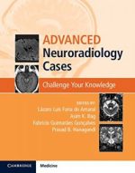 advanced neuroradiology cases: challenge your knowledge