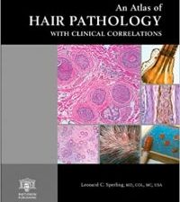 an atlas of hair pathology with clinical correlations (the encyclopedia of visual medicine series) 1st edition