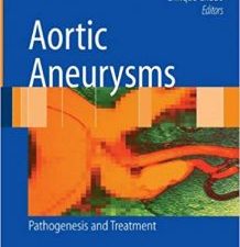 aortic aneurysms: pathogenesis and treatment