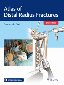 atlas of distal radius fractures