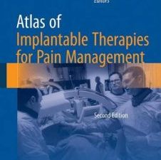 atlas of implantable therapies for pain management