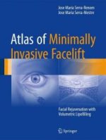 atlas of minimally invasive facelift: facial rejuvenation with volumetric lipofilling