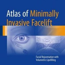 atlas of minimally invasive facelift: facial rejuvenation with volumetric lipofilling