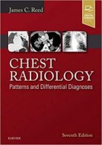 chest radiology: patterns and differential diagnoses – 7th edition (december 2017 release)
