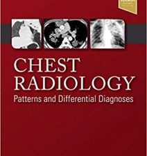 chest radiology: patterns and differential diagnoses – 7th edition (december 2017 release)