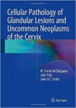 cellular pathology of glandular lesions and uncommon neoplasms of the cervix